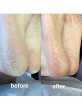 #けあなちゅらる/フットケア☆エスプランニング