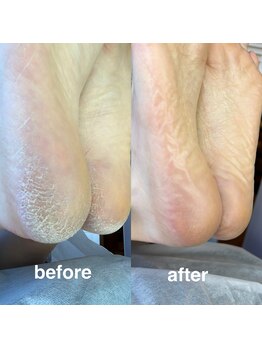 #けあなちゅらる/フットケア☆エスプランニング