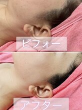 オカオソリ(Okaosori)/お顔のビフォー・アフター♪