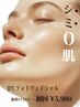 初回割引【シミ改善/赤ら顔/開き毛穴】IPLフォト美白フェイシャル＋RF