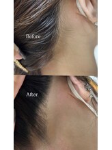 ルモア(Lumor)/レディース｜うなじWax