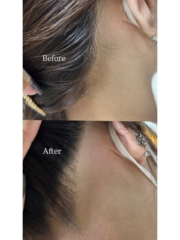 ルモア(Lumor)/レディース｜うなじWax