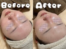 グラシア 倉敷店(Gracia)/お客様の施術事例