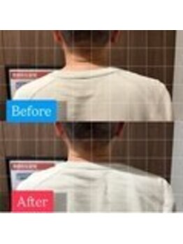 ナオル整体 宮崎院(NAORU整体)/40代男性施術事例【肩の高さ】