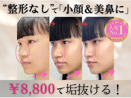 隆鼻矯正専門店 ラプリセレネ (Raplit Selene)の写真