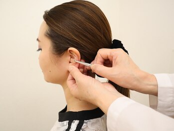スーパースリムダイエット茅ヶ崎 茅ヶ崎整体院/耳ツボ施術