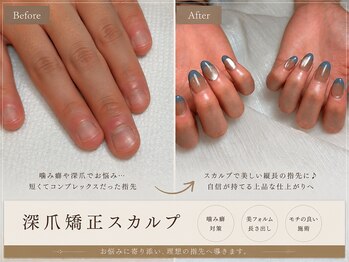ビベリー(BEVERY)の写真/短い爪・折れた爪・深爪でお悩みの方も◎長さ出し・深爪矯正で、自信が持てる理想の美フォルムへ。