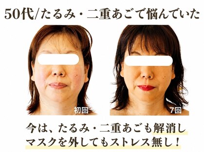 ランティル(l’until)の写真