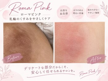 サクラ(SAKURA)の写真/【ローマピンク乳輪専門店】効果の高いローマピンクを更に追求し、乳輪に特化したサロンです。