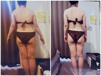 パーフェクトボディプレミアム 名古屋駅前店(PERFECT BODY PREMIUM)/お客様 ビフォーアフター(19)