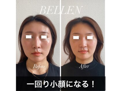 ベレン 堀江(BELLEN)の写真