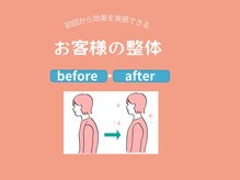 本八幡整体院やわらぎ/お客様の整体　before after