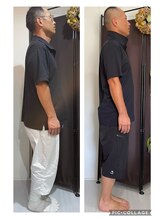 フェザー(Feather)/美容整骨お顔＋身体3回の変化♪