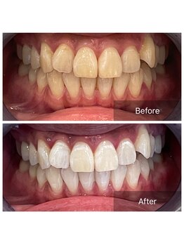 ライエ(Raie)/Before After