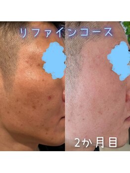 ザ スパ ゲンズブール/
