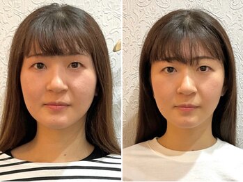 美容整体ウェリナ あま甚目寺院/小顔矯正/骨盤矯正/美脚サロン