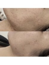 ヴェルシック(Belchic)/ノーファンデ美肌叶えます