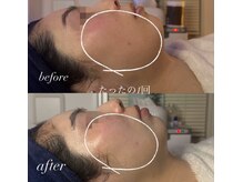 オーシャンブルーム 目黒(OceanBloom)/