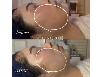 オーシャンブルーム 目黒(OceanBloom)/