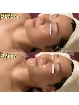 アユスリム(AYU SLIM)/一回でも変化できるの充実小顔