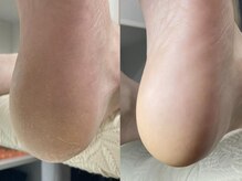 ランランネイル(rangrang nail)