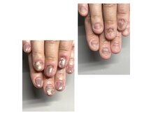 デジール(Desir)の雰囲気（深爪矯正しながらデザインも楽しめます。（画像はイメージです））