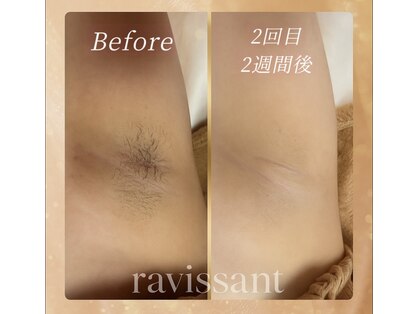 ラヴィソン(ravissant)の写真