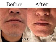 ソウ 越前店(sou.)/