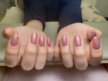 パラジェル・フィルインも対応