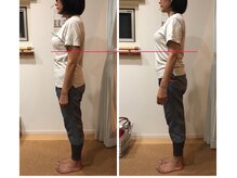 わたしの/全身骨格矯正