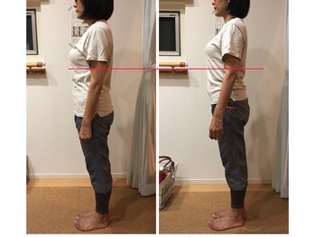 わたしの/全身骨格矯正