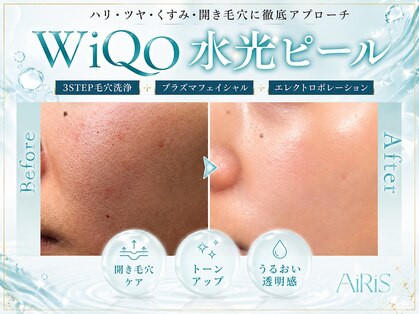 アイリス(AiRiS)の写真