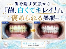 博多ホワイトニング福岡 博多駅前筑紫口店