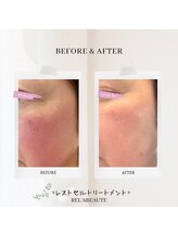 サロンドボーテ オランジュ(salon de beaute Orange)/レストセルトリートメント