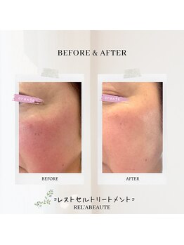 サロンドボーテ オランジュ(salon de beaute Orange)/レストセルトリートメント