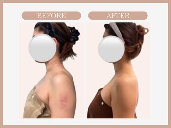 スリムライン 盛岡店(The Slim Line)/before→after