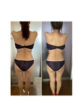 アリス 赤坂/上半身4カップ＆太もも4カップ