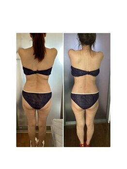 アリス 赤坂/上半身4カップ＆太もも4カップ