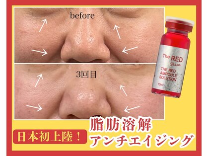 エイジングケアサロンシー(aging care salon cee)の写真