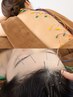 【鍼灸】自律神経・睡眠改善/自律神経・睡眠改善ヘッド鍼と生体電流エステ
