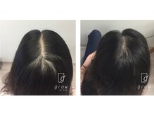 頭皮ケア専門サロン グロウ(grow by k-two)