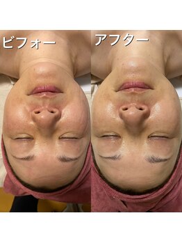 アロマエステサロン エッセンス/ビフォーアフター