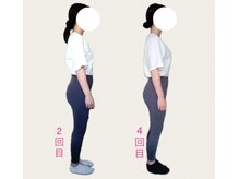 フォーシー(4C)/Before/After