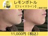 【フェイスライン.小顔】脂肪分解!!レモンボトルを微細孔から導入＆EMS!!