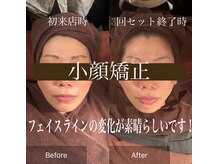 美容整体 ココ(COCO)/