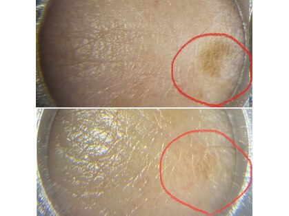 アミュレット(AMULET)の写真