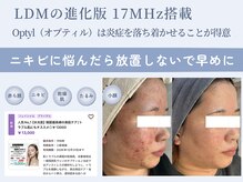 パリスヒロトン(PARIS HIROTON)の雰囲気（Optyl（オプティル）＆HAAB REPROはニキビでお悩みの方に最適）