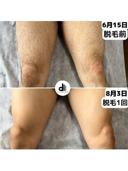 ビューティーサロン マル(Beauty Salon MARU)/