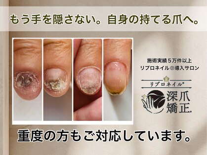 レアムネイル(Leam nail)の写真