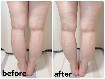 サロンアン(Salon an)/むくみが取れてすっきり!